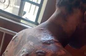 Landlady Attacks Tenant, Pours Hot Water On Her