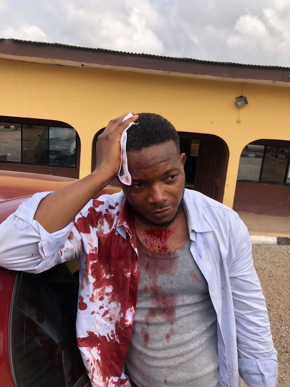 Breaking: Journalists Demand Justice For Brutalised Colleague By DSS Officers In Oyo
